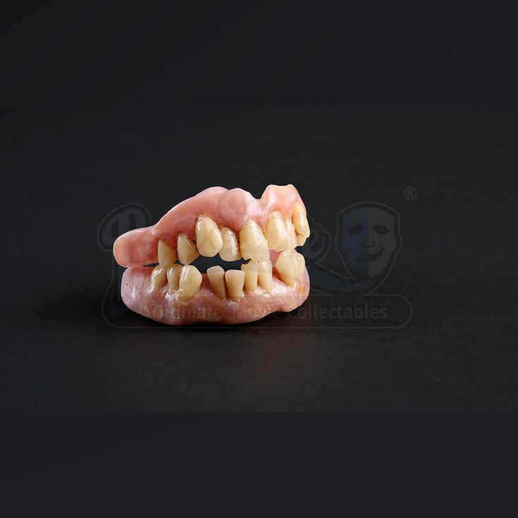 Francis Dolarhydes (Richard Armitage) Veneers HANNIBAL (20132015)