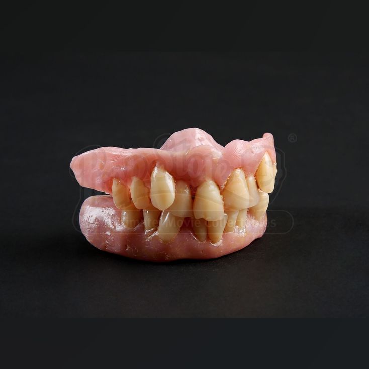 Francis Dolarhydes (Richard Armitage) Veneers HANNIBAL (20132015)